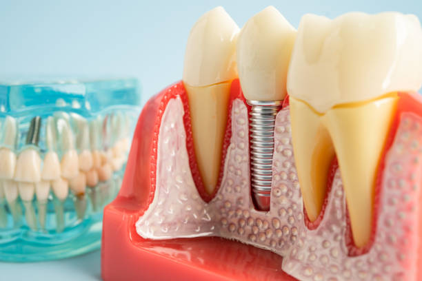 Best Periodontal (Gum) Disease Treatment  in Bisbee, AZ